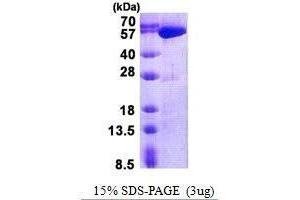Figure annotation denotes ug of protein loaded and % gel used. (USP14 蛋白)
