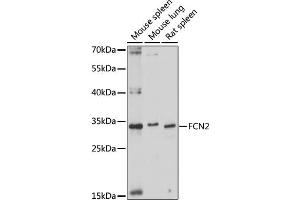 Western blot analysis of extracts of various cell lines, using FCN2 antibody (ABIN7267201) at 1:1000 dilution. (Ficolin 2 抗体  (AA 230-290))