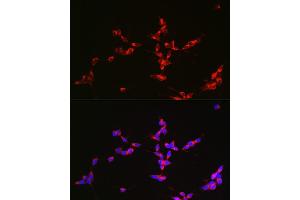 Immunofluorescence analysis of SH-SY5Y cells using Glutaminase (GLS) antibody (ABIN1680034, ABIN3018235, ABIN3018236 and ABIN6220412) at dilution of 1:150. (Glutaminase 抗体  (AA 610-669))