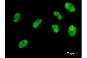 Immunofluorescence of monoclonal antibody to NHLH2 on HeLa cell. (NHLH2 抗体  (AA 36-135))