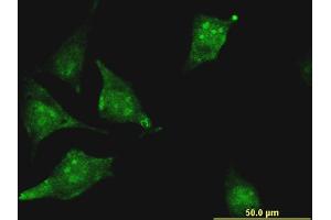 Immunofluorescence (IF) image for anti-Cystathionine-beta-Synthase (CBS) (AA 1-100) antibody (ABIN514088)