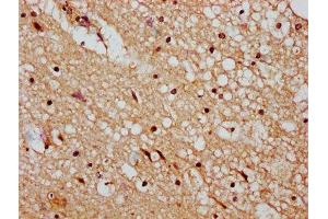 IHC image of ABIN7150197 diluted at 1:400 and staining in paraffin-embedded human brain tissue performed on a Leica BondTM system. (DMAP1 抗体  (AA 250-300))