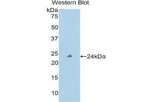 Detection of Recombinant PXDN, Human using Polyclonal Antibody to Peroxidasin Homolog (PXDN) (Peroxidasin 抗体  (AA 76-260))