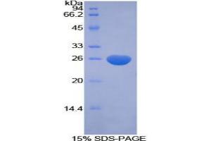 SDS-PAGE analysis of Human CFC1 Protein. (CFC1 蛋白)