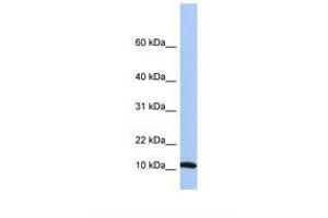Image no. 1 for anti-Finkel-Biskis-Reilly Murine Sarcoma Virus (FBR-MuSV) Ubiquitously Expressed (FAU) (C-Term) antibody (ABIN6749758) (FAU 抗体  (C-Term))
