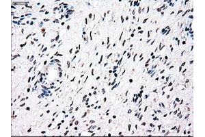 Immunohistochemical staining of paraffin-embedded Ovary tissue using anti-NRBP1mouse monoclonal antibody. (NRBP1 抗体)