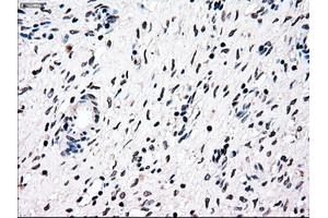 Immunohistochemical staining of paraffin-embedded Ovary tissue using anti-NRBP1mouse monoclonal antibody.