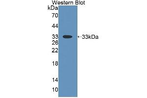 Western blot analysis of the recombinant protein. (THYN1 抗体  (AA 1-226))