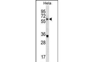 KLH22 Antibody (C-term) (ABIN1537487 and ABIN2849661) western blot analysis in Hela cell line lysates (35 μg/lane). (KLHL22 抗体  (C-Term))