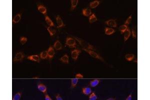 Immunofluorescence analysis of NIH-3T3 cells using STK3 Polyclonal Antibody at dilution of 1:100 (40x lens). (STK3 抗体)