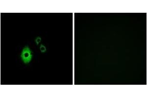 Immunofluorescence analysis of A549 cells, using KCNJ5 Antibody. (KCNJ5 抗体  (AA 370-419))