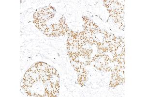 anti-RecQ Protein-Like (DNA Helicase Q1-Like) (RECQL) (AA 1-50) antibody