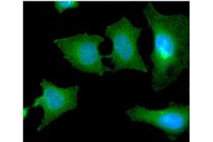 ICC/IF analysis of SBDS in HeLa cells line, stained with DAPI (Blue) for nucleus staining and monoclonal anti-human SBDS antibody (1:100) with goat anti-mouse IgG-Alexa fluor 488 conjugate (Green). (SBDS 抗体)