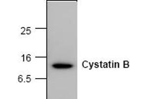 Western Blotting (WB) image for anti-Cystatin B (Stefin B) (CSTB) antibody (ABIN126940) (CSTB 抗体)