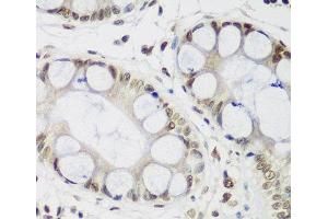 Immunohistochemistry of paraffin-embedded Human gastric using CBX3 Polyclonal Antibody at dilution of 1:200 (40x lens). (CBX3 抗体)