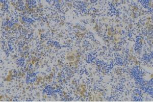 ABIN6278017 at 1/100 staining Human lymph node tissue by IHC-P. (Neuropilin 1 抗体)