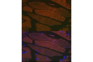 Immunofluorescence analysis of mouse bone marrow cells using SERC/ Rabbit mAb (9639) at dilution of 1:100 (40x lens). (ATP2A1/SERCA1 抗体)