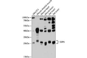 Western blot analysis of extracts of various cell lines, using SSPN antibody (ABIN6132896, ABIN6148488, ABIN6148489 and ABIN6215784) at 1:3000 dilution.