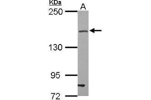 WB Image Sample (30 ug of whole cell lysate) A: U87-MG 5% SDS PAGE antibody diluted at 1:500 (TJP2 抗体)