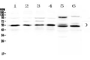 Western blot analysis of RXRA using anti-RXRA antibody . (Retinoid X Receptor alpha 抗体  (AA 226-462))