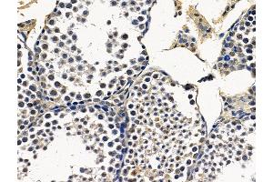 ABIN7096383 and ABIN7100447 at 1/100 staining mouse testis tissue by IHC-P. (MIR22HG 抗体)