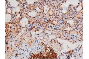 ABIN6267487 at 1/200 staining Mouse lung tissue sections by IHC-P. (alpha Adducin 抗体  (pSer726))