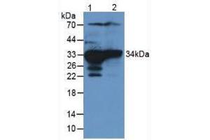 Western blot analysis of (1) Rat Liver Tissue and (2) Rat Kidney Tissue. (SULT1A1 抗体  (AA 3-291))