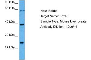 Host: Rabbit Target Name: FOXA3 Sample Tissue: Mouse Liver Antibody Dilution: 1ug/ml (FOXA3 抗体  (C-Term))