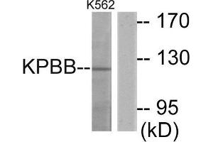 Western Blotting (WB) image for anti-Phosphorylase Kinase, beta (PHKB) (Internal Region) antibody (ABIN1849876) (PHKB 抗体  (Internal Region))