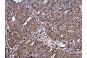 Immunohistochemistry (IHC) image for anti-Actin, beta (ACTB) (C-Term) antibody (ABIN2854710)