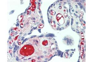 Human Placenta: Formalin-Fixed, Paraffin-Embedded (FFPE) (PLAT 抗体  (AA 311-487))