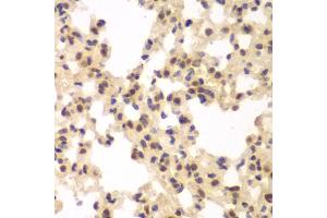 Immunohistochemistry of paraffin-embedded rat lung using CSNK2A2 antibody (ABIN6290214) at dilution of 1:100 (40x lens). (CSNK2A2 抗体)