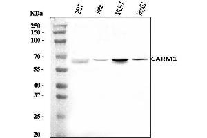 Western blot analysis of CARM1 using anti-CARM1 antibody (ABIN7602230).