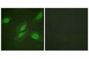 Immunofluorescence analysis of HeLa cells, using Akt (Ab-326) antibody. (AKT1 抗体  (Tyr326))