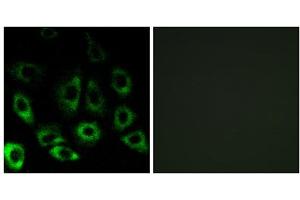 Immunofluorescence analysis of A549 cells, using MBTPS2 antibody. (MBTPS2 抗体  (Internal Region))
