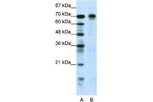 Human Jurkat; WB Suggested Anti-HIC1 Antibody Titration: 0. (HIC1 抗体  (N-Term))