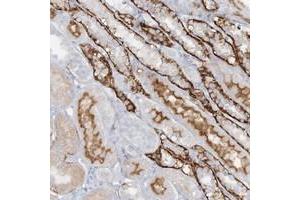Immunohistochemical staining of human kidney with ATP11A polyclonal antibody  shows strong cytoplasmic and membranous positivity in distal tubules. (ATP11A 抗体)