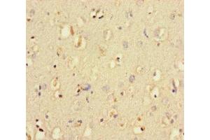 Immunohistochemistry of paraffin-embedded human brain tissue using ABIN7150193 at dilution of 1:100 (LIG3 抗体  (AA 809-928))