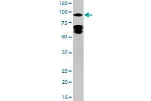 Western blot analysis of STAT5A (phospho Y694) polyclonal antibody  in HepG2 cell lysate (35 ug/lane). (STAT5A 抗体  (pTyr694))