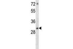 ATF5 antibody western blot analysis in MCF-7 lysate (ATF5 抗体  (AA 188-216))