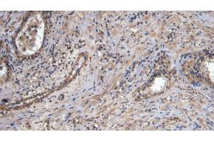 Detection of PECAM1 in Human Prostate Tissue using Polyclonal Antibody to Platelet/Endothelial Cell Adhesion Molecule (PECAM1)