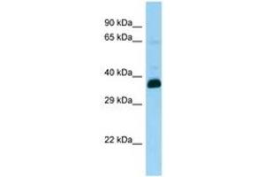 Image no. 1 for anti-Snurportin 1 (SNUPN) (AA 24-73) antibody (ABIN6748330) (Snurportin 1 抗体  (AA 24-73))