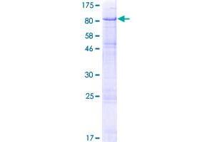 Uromodulin Protein (UMOD) (AA 1-611) (GST tag)