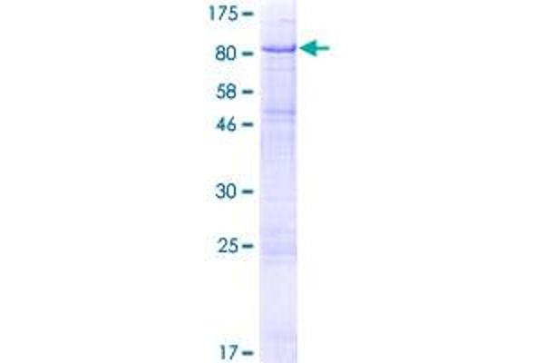 Uromodulin Protein (UMOD) (AA 1-611) (GST tag)
