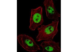Immunofluorescence (IF) image for anti-Paired-Like Homeobox 2b (PHOX2B) antibody (ABIN2996148) (PHOX2B 抗体)