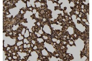 ABIN6261309 and ABIN6277565 at 1/100 staining Mouse lung tissue by IHC-P.
