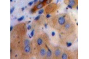 #VALUE! (C19ORF80 抗体  (AA 24-196))