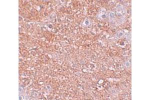 Immunohistochemical staining of mouse liver cells with SLC39A12 polyclonal antibody  at 2. (SLC39A12 抗体  (N-Term))