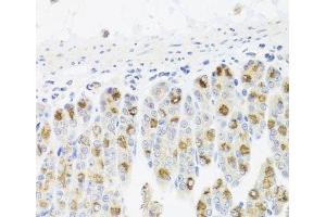 Immunohistochemistry of paraffin-embedded Mouse stomach using CDC45 Polyclonal Antibody at dilution of 1:100 (40x lens).