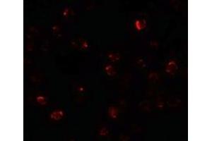 Immunofluorescence of ZBTB40 in Raji cells with ZBTB40 antibody at 20 µg/ml. (ZBTB40 抗体  (N-Term))